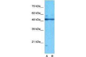 Image no. 3 for anti-AT Rich Interactive Domain 5A (MRF1-Like) (ARID5A) (N-Term) antibody (ABIN2784380)