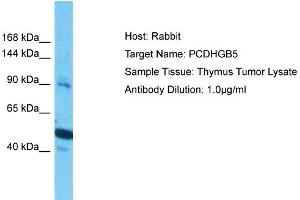 Image no. 1 for anti-Protocadherin gamma Subfamily B, 5 (PCDHGB5) (Middle Region) antibody (ABIN2783727)