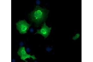 Image no. 1 for anti-EPM2A (Laforin) Interacting Protein 1 (EPM2AIP1) antibody (ABIN2720298)