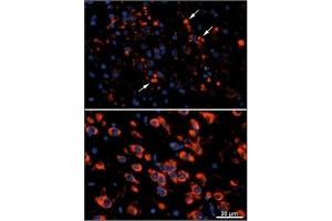 Image no. 2 for anti-Microtubule-Associated Protein 1 Light Chain 3 alpha (MAP1LC3A) antibody (ABIN5551132)