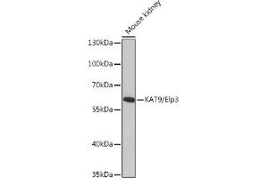ELP3/KAT9 anticorps  (AA 358-547)