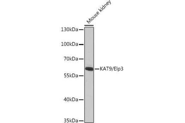 ELP3/KAT9 anticorps  (AA 358-547)