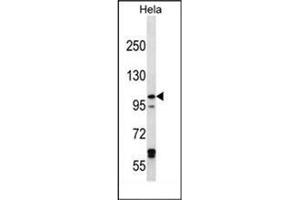 Image no. 3 for anti-Iron-Responsive Element Binding Protein 2 (IREB2) (AA 208-238), (Middle Region) antibody (ABIN952944)