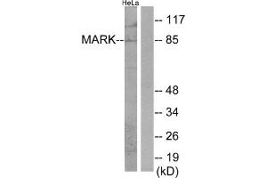 Image no. 1 for anti-MAP/microtubule Affinity-Regulating Kinase 1 (MARK1) (Internal Region) antibody (ABIN1850026)