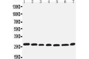 Image no. 2 for anti-Eukaryotic Translation Initiation Factor 6 (EIF6) (AA 82-96), (Middle Region) antibody (ABIN3044059)