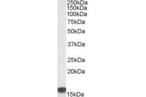 Image no. 2 for anti-S100 Calcium Binding Protein A9 (S100A9) (Internal Region) antibody (ABIN335161)