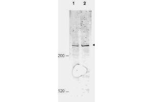 Western blot using  Affinity Purified anti-APC1 pS377 antibody shows detection of a band ~215 kDa corresponding to phosphorylated human APC1 (arrowhead).