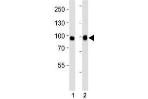 Image no. 1 for anti-Fibroblast Growth Factor Receptor 3 (FGFR3) (AA 449-482) antibody (ABIN3030955)