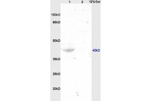 Image no. 7 for anti-G Protein-Coupled Estrogen Receptor 1 (GPER) (AA 251-375) antibody (ABIN685717)