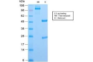 Image no. 1 for anti-CD6 (CD6) antibody (ABIN6941064)