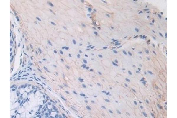 Thrombospondin 1 antibody  (AA 515-671)