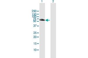 Image no. 2 for anti-Hemopoietic Cell Kinase (HCK) (AA 1-505) antibody (ABIN947963)