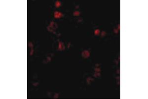 Image no. 2 for anti-Apoptosis Antagonizing Transcription Factor (AATF) (C-Term) antibody (ABIN6655674)