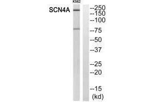 SCN4A Antikörper