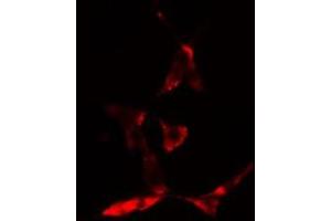 Image no. 1 for anti-N-Ethylmaleimide-Sensitive Factor (NSF) antibody (ABIN6258288)