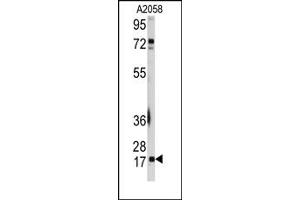 Image no. 2 for anti-Ubiquitin-Conjugating Enzyme E2I (UBE2I) (N-Term) antibody (ABIN356594)