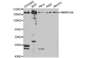 Image no. 2 for anti-SWI/SNF Related, Matrix Associated, Actin Dependent Regulator of Chromatin, Subfamily A, Member 4 (SMARCA4) antibody (ABIN3022959)
