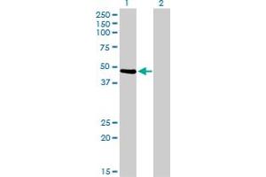 Image no. 4 for anti-Twinfilin, Actin-Binding Protein 1 (TWF1) (AA 80-252) antibody (ABIN562524)