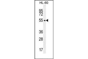 Image no. 3 for anti-Solute Carrier Family 35, Member E2 (SLC35E2) (AA 1-30), (N-Term) antibody (ABIN954823)