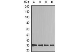 Image no. 2 for anti-Triosephosphate Isomerase 1 (TPI1) (full length) antibody (ABIN6005030)