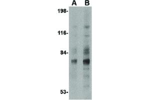 Image no. 3 for anti-Syntaphilin (SNPH) (N-Term) antibody (ABIN6656393)
