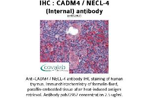 Image no. 2 for anti-Cell Adhesion Molecule 4 (CADM4) (Internal Region) antibody (ABIN1732541)