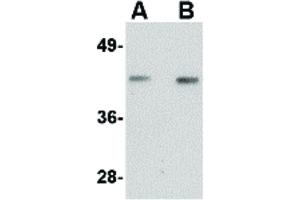 Western Blot of Nanos1 Antibody Western Blot of Nanos1 antibody.
