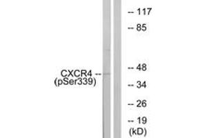 Western blot analysis of extracts from HuvEc cells treated with etoposide 25uM 24H, using CXCR4 (Phospho-Ser339) Antibody.