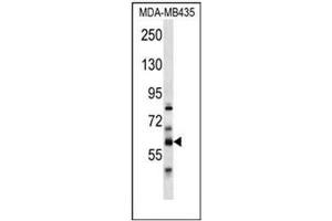 Image no. 1 for anti-phosphatidylserine Synthase 2 (PTDSS2) (AA 1-30), (N-Term) antibody (ABIN954366)