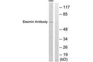 Image no. 1 for anti-Desmin (DES) (AA 421-470) antibody (ABIN1533253)