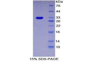 Image no. 1 for Interferon alpha/beta Receptor 1 (IFNAR1) (AA 244-512) protein (His tag) (ABIN1878981)