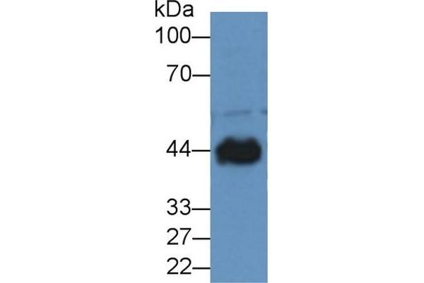 CKM anticorps  (AA 11-367)