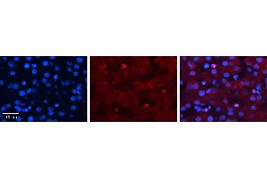 Image no. 3 for anti-Zinc Finger, CCCH-Type with G Patch Domain (ZGPAT) (N-Term) antibody (ABIN2775532)