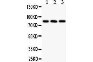 Image no. 1 for anti-Protein Phosphatase 3, Catalytic Subunit, alpha Isoform (PPP3CA) (AA 488-521), (C-Term) antibody (ABIN3042493)