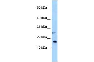 Image no. 1 for anti-Nudix (Nucleoside Diphosphate Linked Moiety X)-Type Motif 15 (NUDT15) (N-Term) antibody (ABIN2783521)