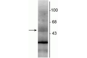 Image no. 2 for anti-Retinoid X Receptor, beta (RXRB) antibody (ABIN361387)