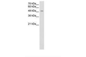Image no. 2 for anti-Monocarboxylate Transporter 3 (MCT3) (AA 251-300) antibody (ABIN205015)