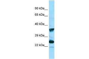 Image no. 1 for anti-MAS-Related GPR, Member X4 (MRGPRX4) (C-Term) antibody (ABIN2788264)