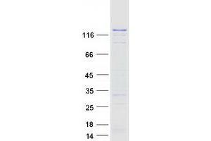Image no. 2 for DNA (Cytosine-5-)-Methyltransferase 3 alpha (DNMT3A) (Transcript Variant 3) (Active) protein (Myc-DYKDDDDK Tag) (ABIN2719617)