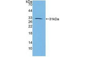 Retinoic Acid Receptor beta Antikörper  (AA 205-451)