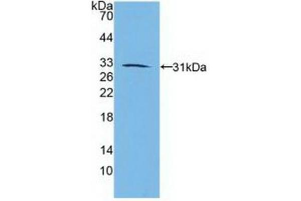 Retinoic Acid Receptor beta 抗体  (AA 205-451)