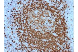Image no. 3 for anti-T-Cell Leukemia/lymphoma 1A (TCL1A) (AA 2-109) antibody (ABIN6940949)