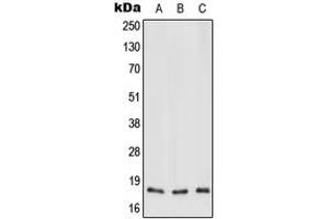 Image no. 1 for anti-Mitochondrially Encoded NADH Dehydrogenase 3 (MT-ND3) (N-Term) antibody (ABIN2707638)