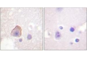 Image no. 2 for anti-Adducin 1 (Alpha) (ADD1) (AA 688-737) antibody (ABIN1532188)
