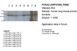 Anti Foxa2 Antikorper Middle Region Produkt Nr Abin2777512