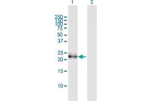 Image no. 2 for anti-Interleukin 27 (IL27) (AA 1-243) antibody (ABIN531419)