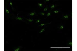 Image no. 5 for anti-Aryl Hydrocarbon Receptor Interacting Protein-Like 1 (AIPL1) (AA 1-384) antibody (ABIN525384)