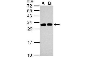 Image no. 1 for anti-Solute Carrier Family 25 (Mitochondrial Carrier, Oxoglutarate Carrier), Member 11 (SLC25A11) (Center) antibody (ABIN2855159)