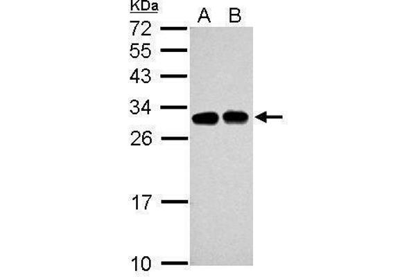 anti-Solute Carrier Family 25 (Mitochondrial Carrier, Oxoglutarate Carrier), Member 11 (SLC25A11) (Center) antibody