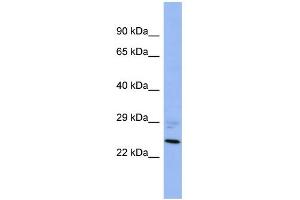 Image no. 1 for anti-Protein Phosphatase, Mg2+/Mn2+ Dependent, 1B (PPM1B) (N-Term) antibody (ABIN2787380)